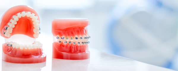 orthodontique